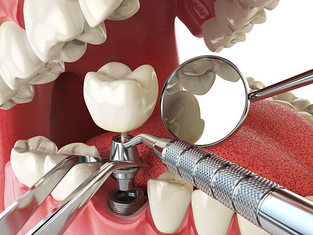 Best Emergency Treatment for Dental Infections or Abscesses in Sinton, TX